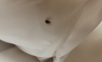 Home Remedies for Bed Bugs: How to Get Rid Of Bed Bugs Naturally